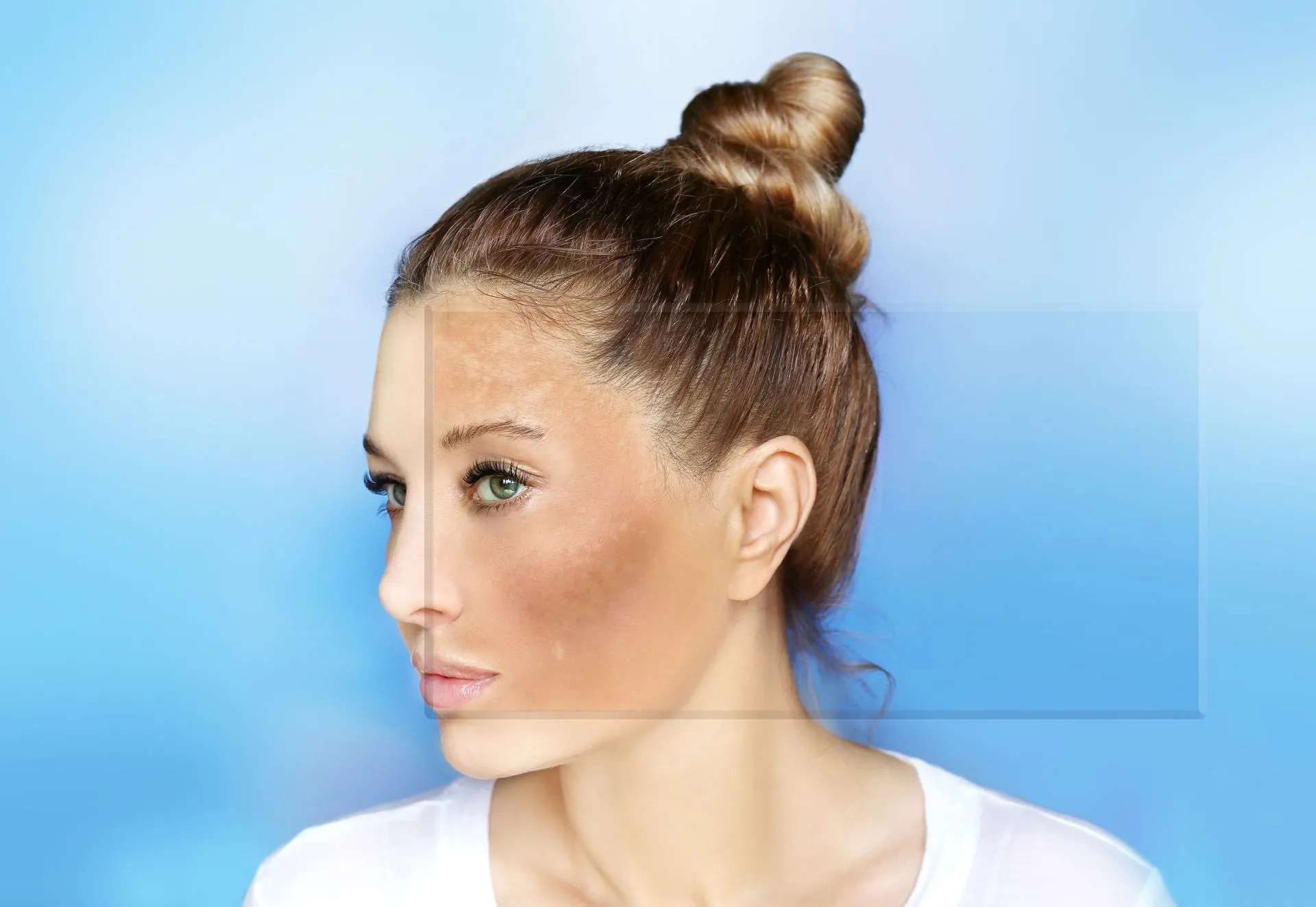 A woman with brown spots on her face is standing in front of a blue background.